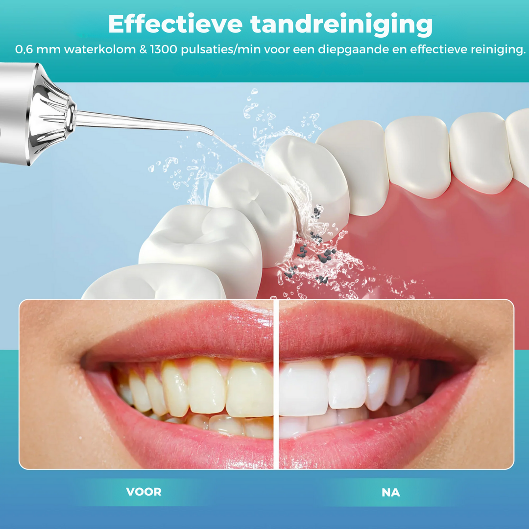 PowerFloss™ | Verbeter uw tandverzorgingsroutine eenvoudig