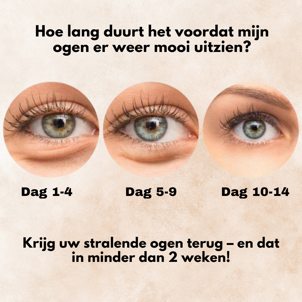 EyeGlow™ | Verminder donkere kringen onmiddellijk