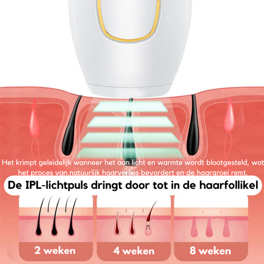 IPL Haarverwijdering™ | Zeg vaarwel tegen ongewenst haar